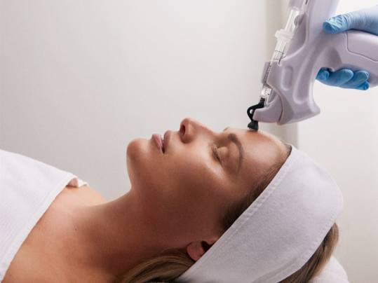 Infuzion Hyaluronbehandlung ohne Nadeln im Gesicht