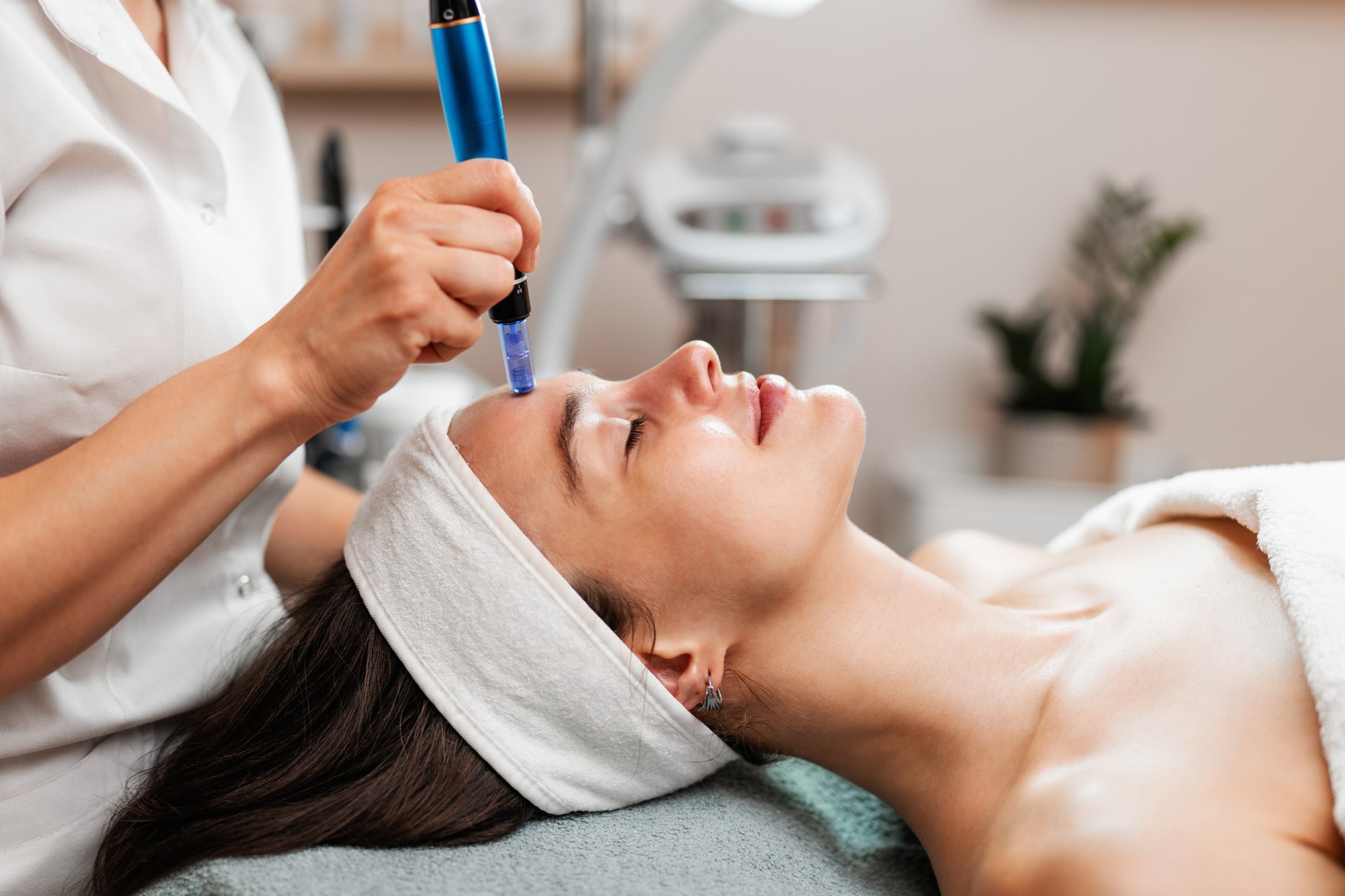 Microneedling-Behandlung mit Dermapen im Gesicht